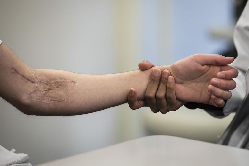 Rylan Wilder, arrene hans synlige på venstre arm, på en fysioterapiøkt på Northwestern Memorial Hospital.