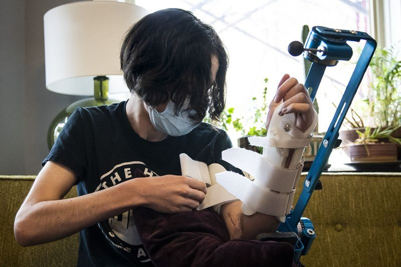 Rylan Wilder har måttet jobbe med fysioterapien på venstre arm hjemme også.