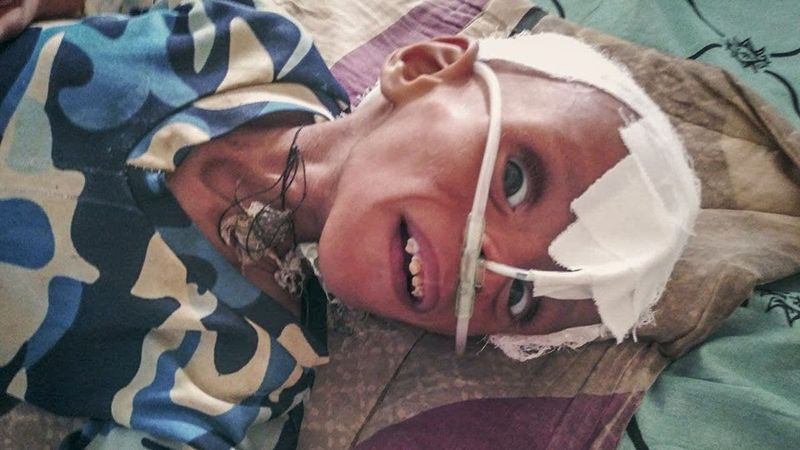 Ein schwer unterernährtes Kind wird in Mekele in der Region Tigray im Norden Äthiopiens auf einer Intensivstation des Ayder Referral Hospital behandelt, wo seit Juni die Medikamente fast aufgebraucht sind und das Krankenhauspersonal nicht bezahlt wird.