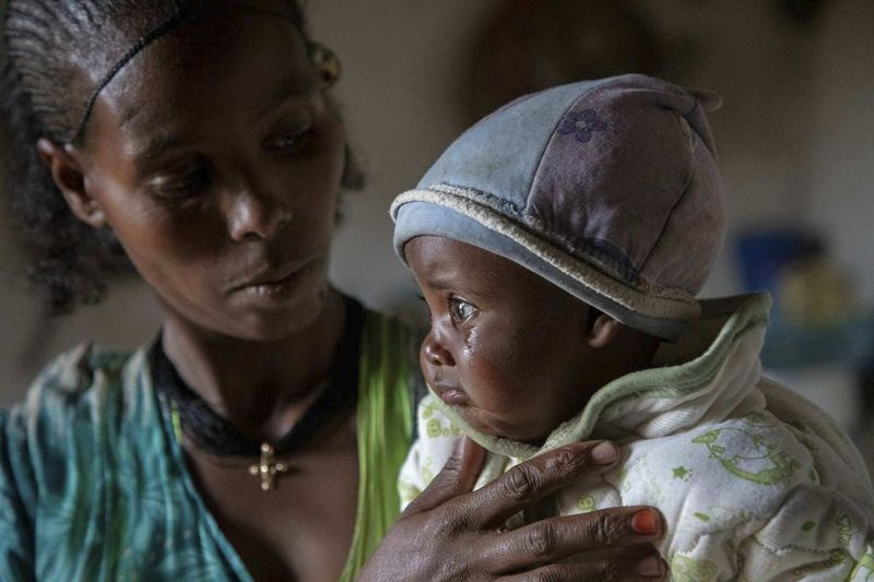 Mutter Abeba (25) tröstet in Gijet in der Region Tigray im Norden Äthiopiens ihr Baby Wegahta, 6 Monate alt, das als schwer unterernährt identifiziert wurde.
