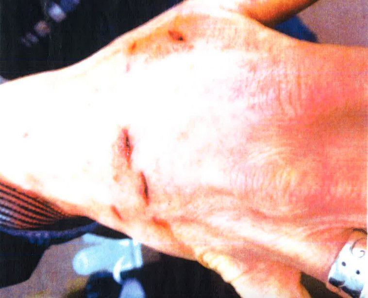 Susan Russell, chef för Chicagos djurvårds- och kontrollskydd, fördes i hast till ett sjukhus under jullovet efter att en pitbull som hon gick på tog en bit ur hennes arm och ben.
