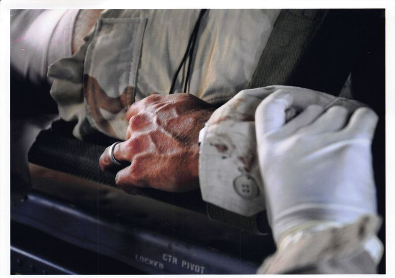Gambar dekat Sgt. Tangan Jim Rudisill, dengan tangan bersarung tangan orang lain memegang pergelangan tangannya, semasa dia dipindahkan dari segi perubatan dari Wilayah Diyala, Iraq, pada tahun 2005. Dia mengalami pelbagai kecederaan dan berkata dia juga melihat perang tol menimpa rakan-rakannya.