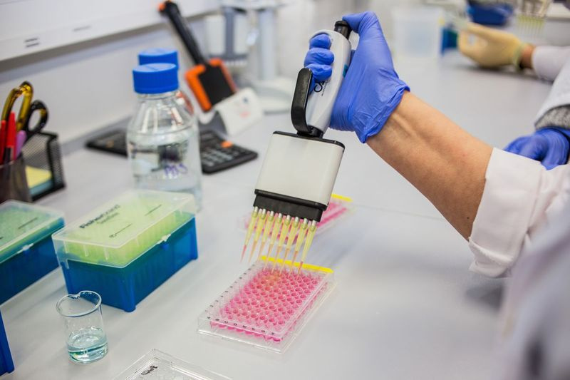 Nové štúdie posilňujú nádeje, že čoskoro môže existovať jednoduchý krvný test, ktorý pomôže diagnostikovať Alzheimerovu chorobu.